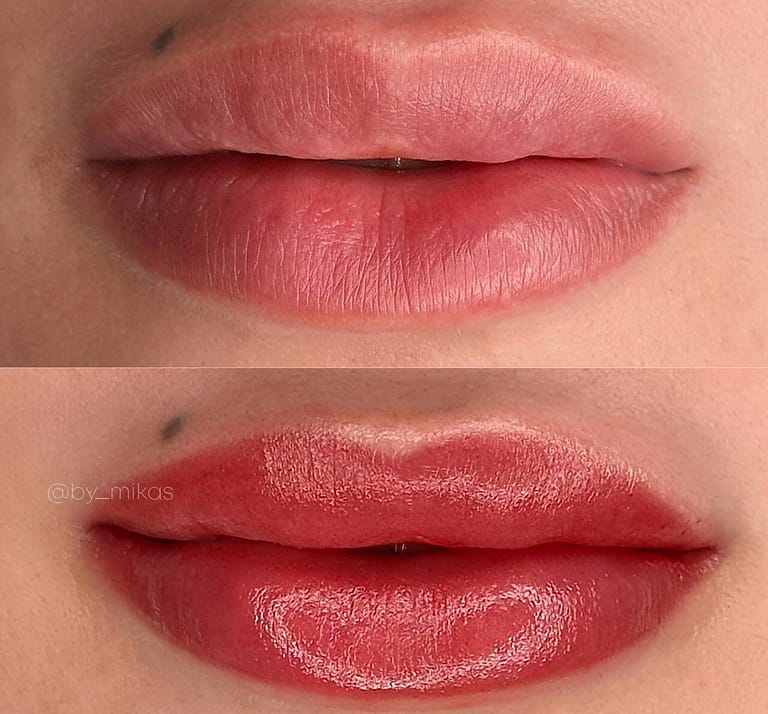 Lip Blush & Lip Lightening : Enhance Your Natural Beauty